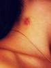 Oops, left You a Hickey!!