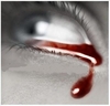 a tear of blood