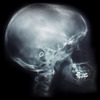head x-ray